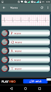 EKG Pro screenshot 2