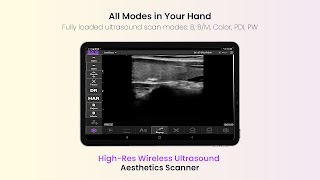 SONOFINDER اسکرین شاٹ 7