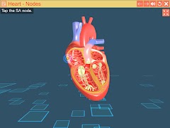 Cardiac pacemaker imagem de tela 5