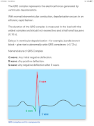 ECG Basics - Full capture d'écran 5