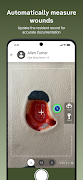 PointClickCare ChartPic स्क्रीनशॉट 1