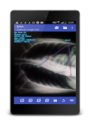 Subroto Angle Aid capture d'écran 3