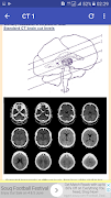 CT Head Basic Interpretation screenshot 2