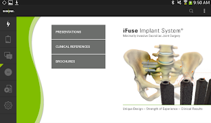 SI-BONE ภาพหน้าจอ 1