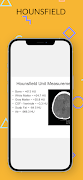 brain ct screenshot 3