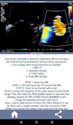 LEARN THE FULL TTE ECHO ULTRASOUND PROTOCOL 截图 6