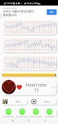 Cardiac Diagnosis (Arrhythmie) Screenshot 3
