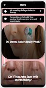 Drema Roller 截圖 4