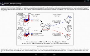 EchoSource تصوير الشاشة 7