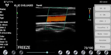 WirelessKUS screenshot 1