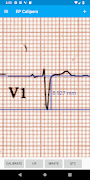 EP Calipers screenshot 4