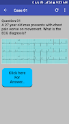 برنامه‌نما ECG Cases عکس از صفحه