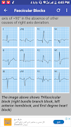 Clinical ECG Guide. スクリーンショット 2