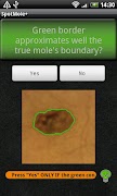 SpotMolePlus screenshot 2