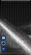 IMV Go Scan স্ক্রিনশট 4