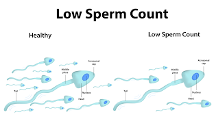 6 Schermata Increase Your Sperm Count
