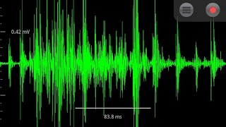 Spike Recorder постер