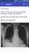 Chest X-Ray Based Cases screenshot 5