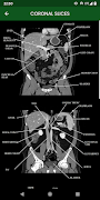 abdominal CT: annotated slices Screenshot 3