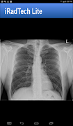 iRadTech Lite syot layar 6