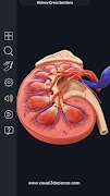 2 Schermata My Urinary System