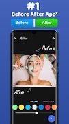 پوستر Diff before after video photo 