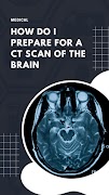 CT Scan Brain Plakat