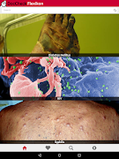 برنامه‌نما DocCheck Flexikon عکس از صفحه