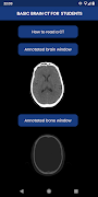 Brain CT : annotated slices poster