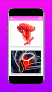Prostate problem captura de pantalla 2