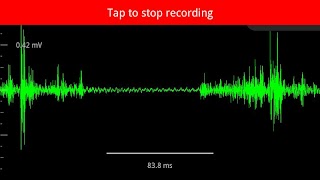Spike Recorder Screenshot 1