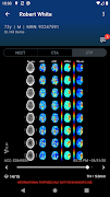 Viz.ai screenshot 1