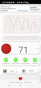 Hartdiagnose (aritmie) screenshot 4
