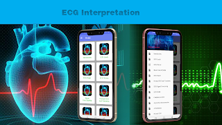 2 Schermata ECG Interpretation Guide