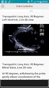 EchoCardioPro スクリーンショット 7