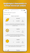 Urine Element Counter 스크린샷 1