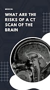 CT Scan Brain 截圖 2