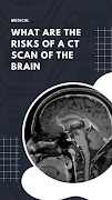 CT Scan Brain スクリーンショット 2