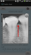 Radiodent 截圖 2