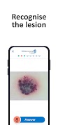 YOUdermoscopy screenshot 2