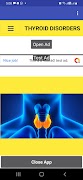 THYROID DISORDERS bài đăng