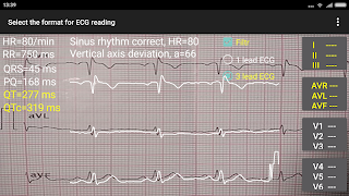 ECG Reader 2 free 截圖 6