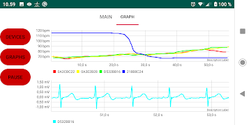 Polar Sensor Logger স্ক্রিনশট 5