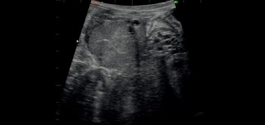 IbexStream Screenshot 1