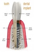 Dentistry โปสเตอร์