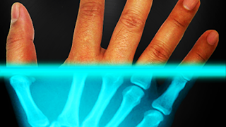 XRAY filter for images poster