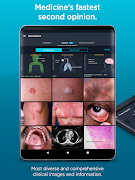 VisualDx اسکرین شاٹ 4