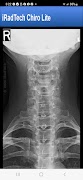 iRadTech Chiro Lite screenshot 4