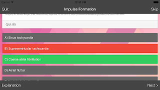 EKG-Master: Quiz & Übungen Screenshot 2