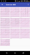 Basic ECG Guide screenshot 7